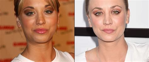 Kaley Cuoco Admits to Plastic Surgery: I Had My Nose Done and My Boobs ...